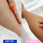 Painless Laser Hair Removal Epilator