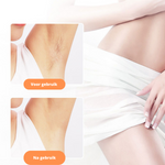 Electric Facial Hair Removal